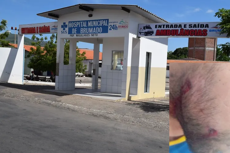 Homem é alvejado ao abrir estabelecimento comercial na zona rural de Brumado