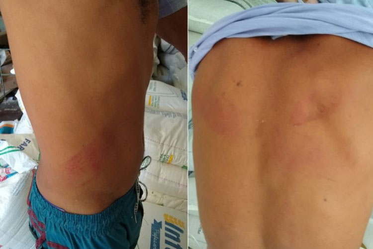 Guanambi: Vereador é acusado de agredir homem com golpes de facão em praça pública