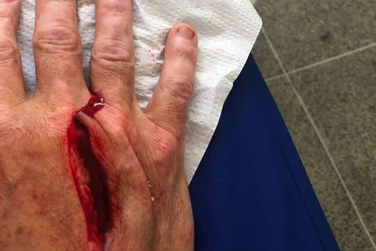 Ex-candidato a vereador sofre tentativa de homicídio dentro de casa em Brumado