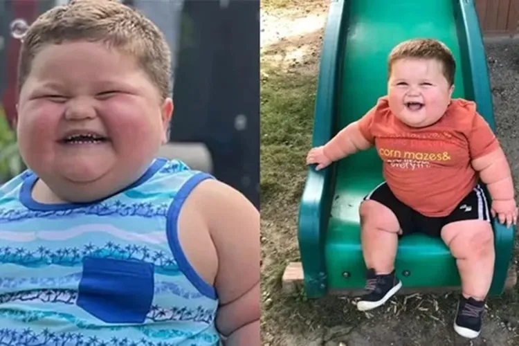 Doença rara faz criança de 3 anos pesar 45 kg e chorar de fome o dia inteiro