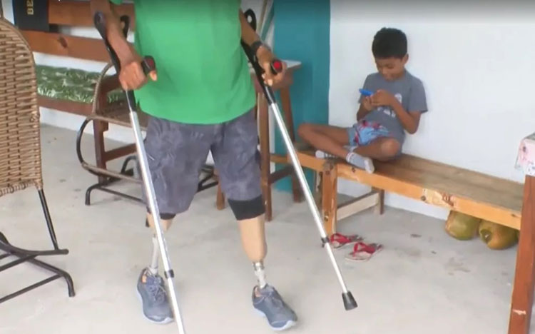 Número de pessoas amputadas aumenta na região Nordeste durante a pandemia