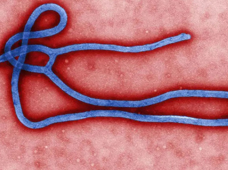 Novo surto de ebola atinge a República Democrática do Congo