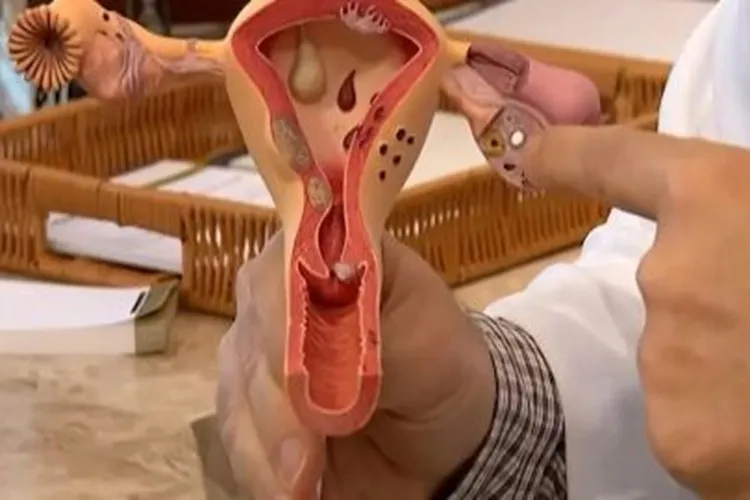 Diagnóstico tardio do câncer de colo de útero eleva custos no SUS