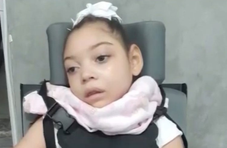 Menina do interior da Bahia com microcefalia receberá medicação à base de Canabidiol