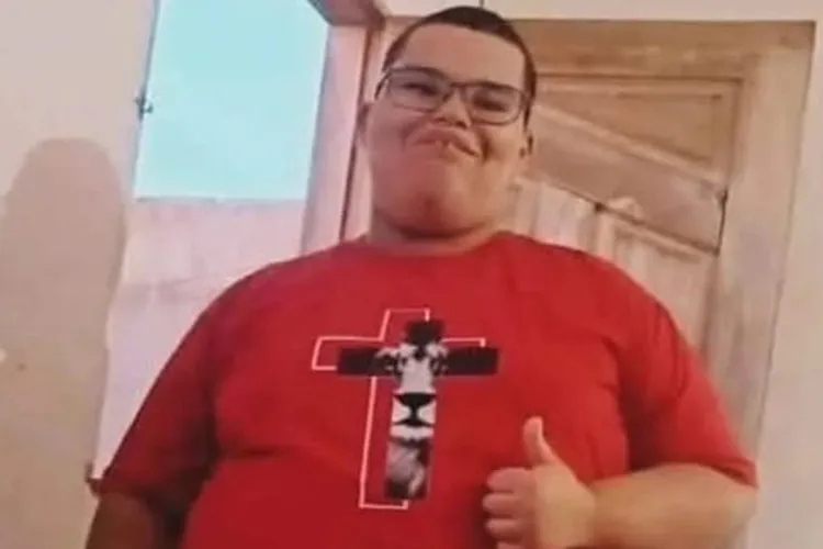 Vitória da Conquista: Adolescente pede ajuda para tratamento de doença rara