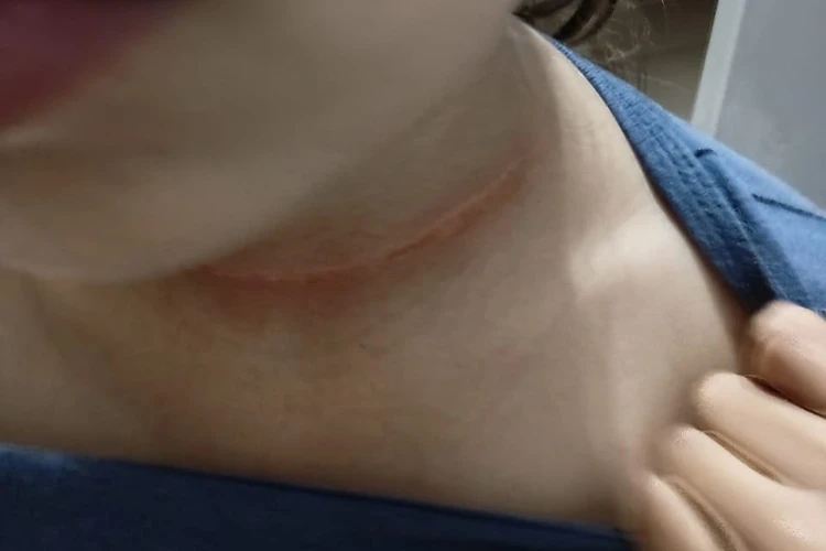 Caetité: Pai faz apelo após filha quase ser decapitada por linha de pedreiro em praça pública