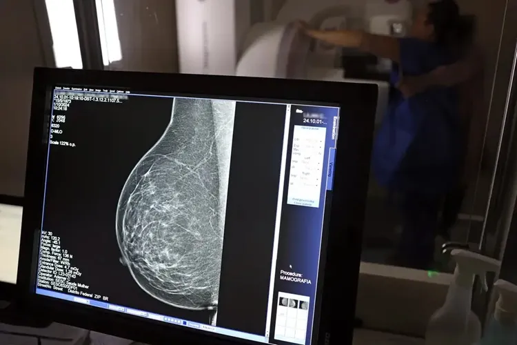 Nova lei reforça direito a três folgas por ano para exames preventivos