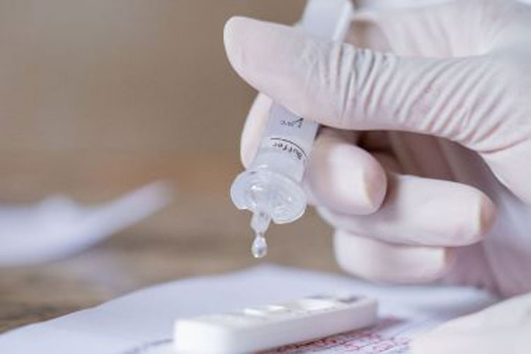 Anvisa libera a venda de autotestes de Covid-19 no Brasil