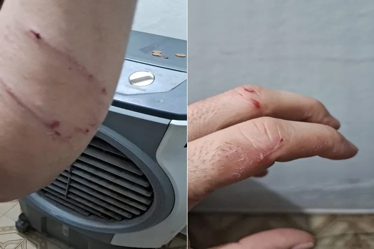 Jornalista entra em luta corporal com pitbull para salvar pet em Guanambi