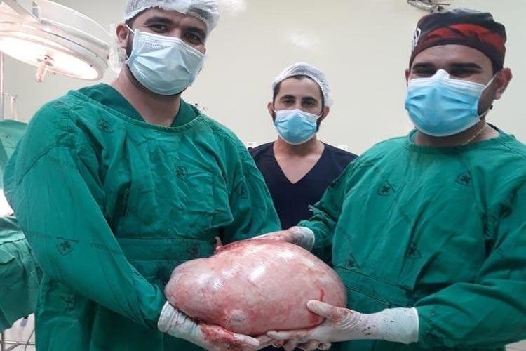 Tumor de quase 20 kg é retirado de jovem de 25 anos em hospital do Acre