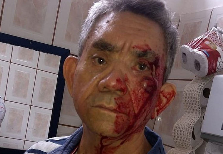 'Não quero mais dar aulas', diz professor agredido por aluno de 14 anos