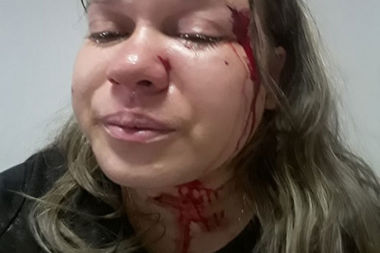 Mulher é espancada pelo filho do namorado em Livramento de Nossa Senhora