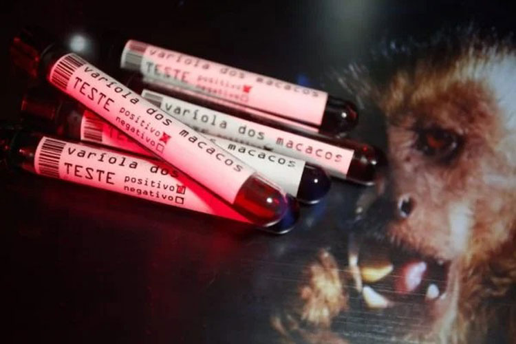 Ministério da Saúde confirma 9º caso de varíola dos macacos no Brasil