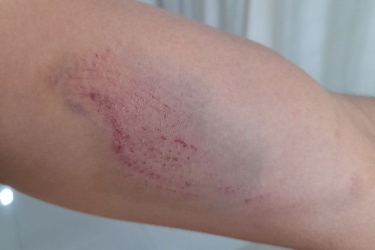 Idoso alveja vizinho em comunidade rural de Iramaia por causa de seriguela