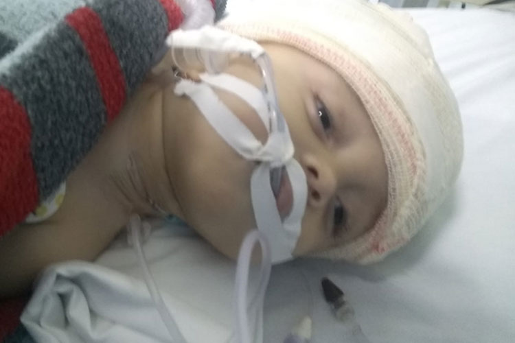 Brumado: Família clama por socorro ao pequeno Bryan diagnosticado com hidrocefalia