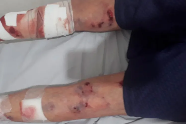 Idoso é atacado por matilha de cachorros em praça na cidade de Malhada de Pedras