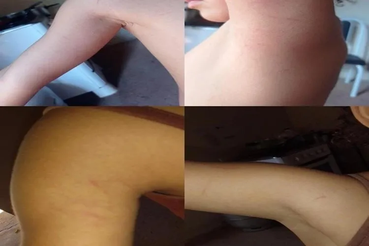 Matina: Tia denuncia diretora de escola por agressões contra sobrinha