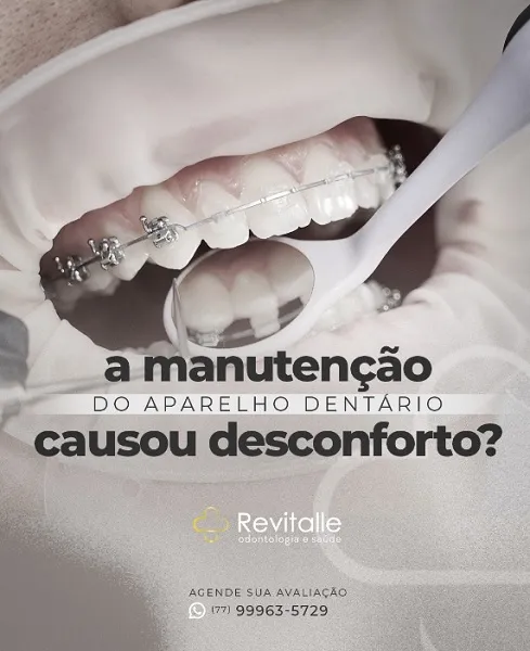 Revitalle dá dicas para aliviar o desconforto causado pelo uso do aparelho ortodôntico