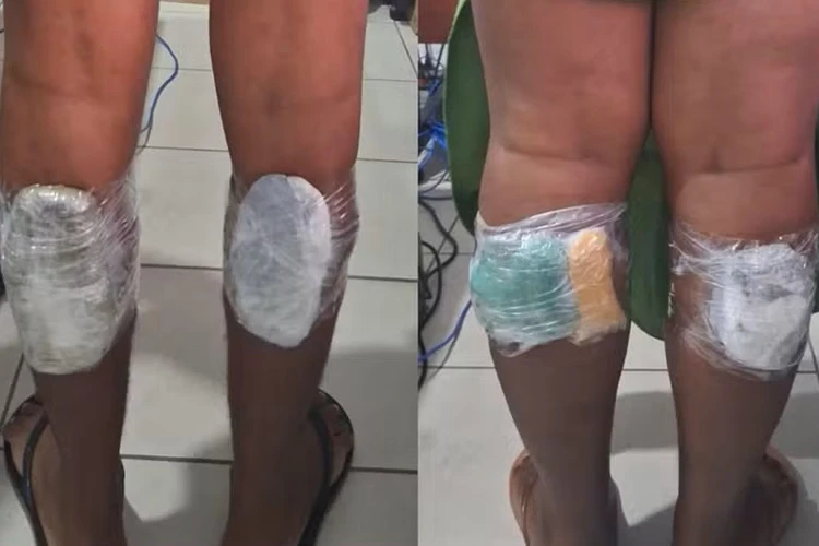 Scanner flagra cinco mulheres com drogas nas panturrilhas na Cadeia de Salvador