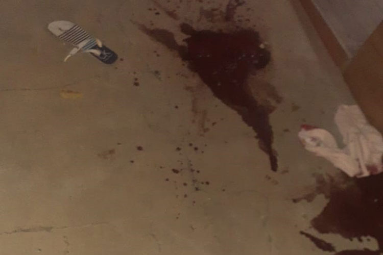 Borracheiro de 33 anos é esfaqueado após discussão em Brumado