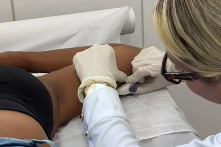 Brumado passa a ofertar implante contraceptivo de longa duração nas UBSs