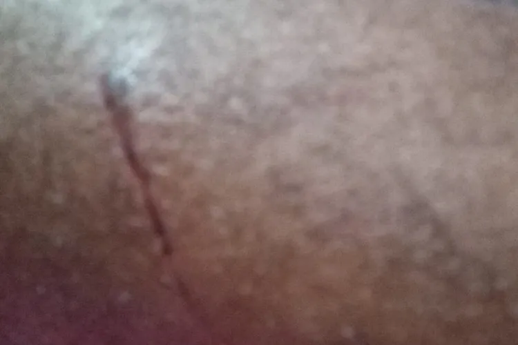 Gari tem perna cortada por caco de vidro descartado em lixo comum em Brumado