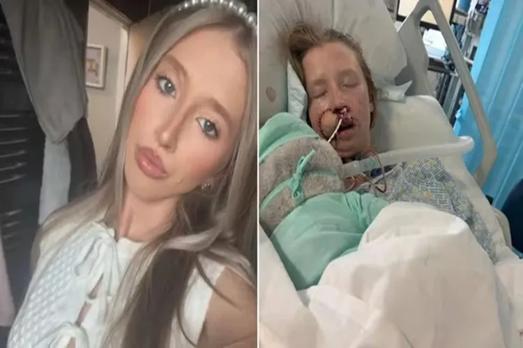 Jovem fica desfigurada após ataque de cão que ela convivia desde filhote