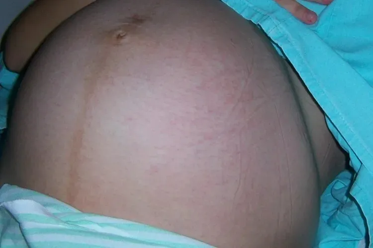 'Dia Delas' promove acolhimento e cuidado para gestantes em Brumado