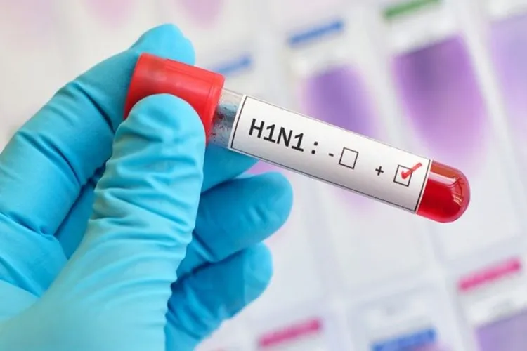 Bahia registrou em 2023 mais de 130 casos e 14 mortes por H1N1