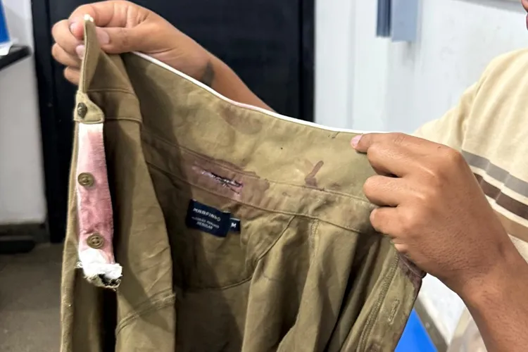 Linha com cerol quase decepa pescoço de estudante de Direito no dia da formatura em Brumado