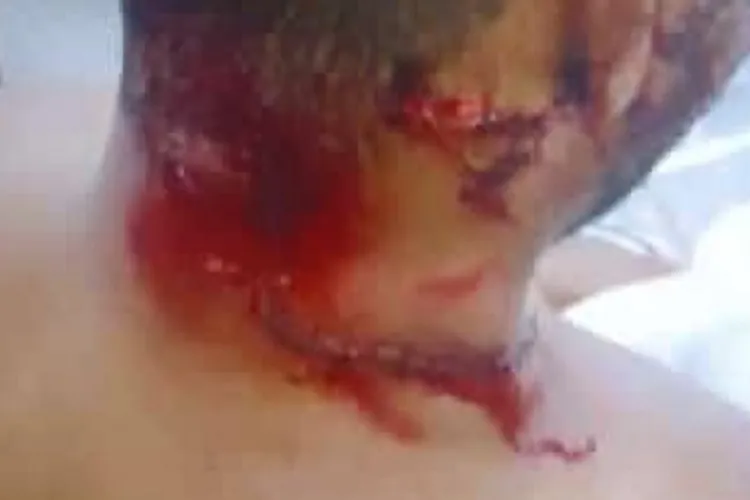 Homem é agerdido após suspeita de molestar menina em Livramento de Nossa Senhora