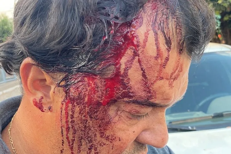 Vereador é detido acusado de invadir casa e agredir agricultor em Cocos