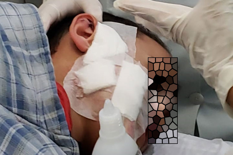 Brumado: Menino de 9 anos é atacado por pitbull a caminho da casa dos avós