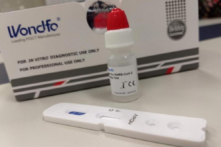 Anvisa libera testes de Covid-19 em farmácias