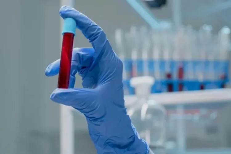 Testemunhas de Jeová mudam regra polêmica sobre doar sangue