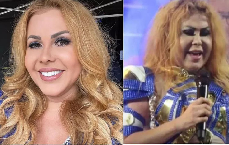 Joelma é diagnosticada com esofagite, gastrite e edema após ser internada em São Paulo