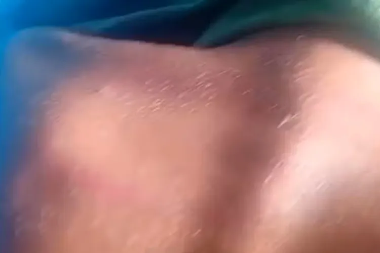 Ilhéus: Professor é denunciado por agredir criança de 8 anos com cipó de goiabeira