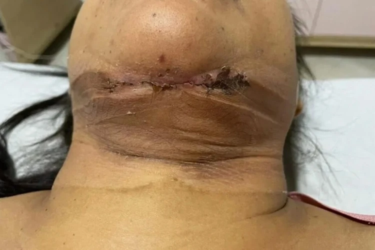 Vitória da Conquista: Dentista é indiciada por causar deformidade permanente em paciente