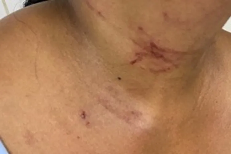 Mulher é agredida pelo companheiro em Guanambi e filha aciona a PM