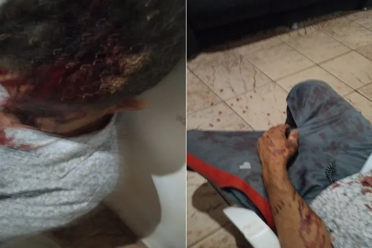 Homem é brutalmente agredido por vizinho após desentendimento na zona rural de Brumado