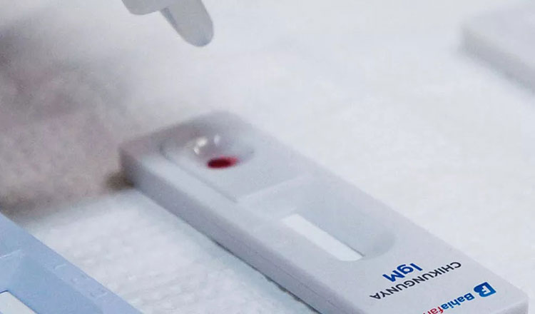 Bahia tem desabastecimento de insumos para testes de dengue, zika e chikungunya