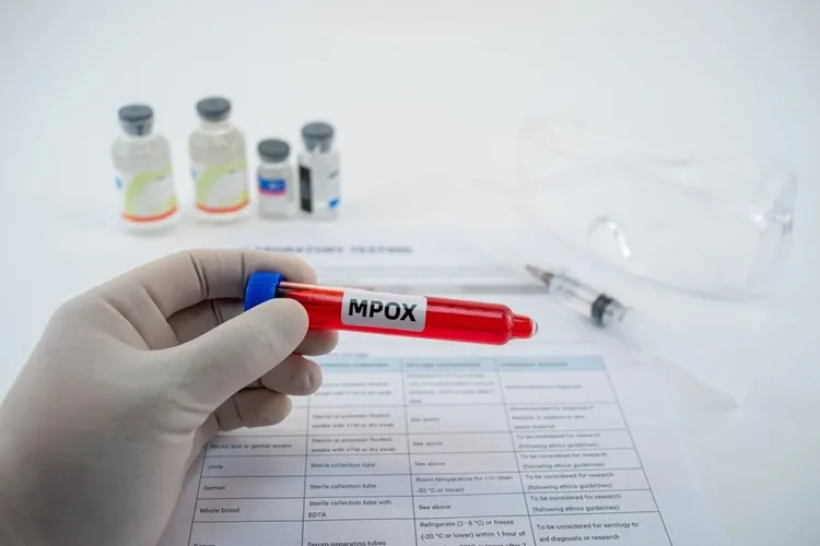 Mpox: Ministério da Saúde coloca oito estados em alerta máximo para a doença