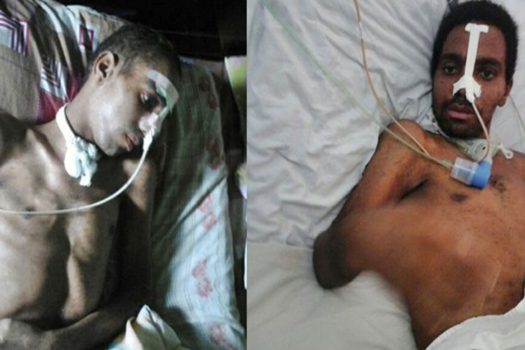 Familiares de jovem que sofreu AVC pedem doações para ajudar no tratamento em Palmas de Monte Alto