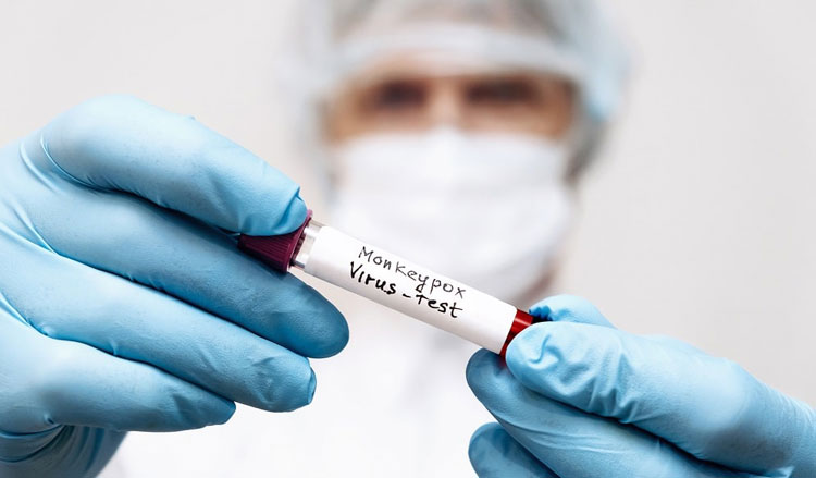 Primeiro infectado com varíola dos macacos recebe alta em São Paulo