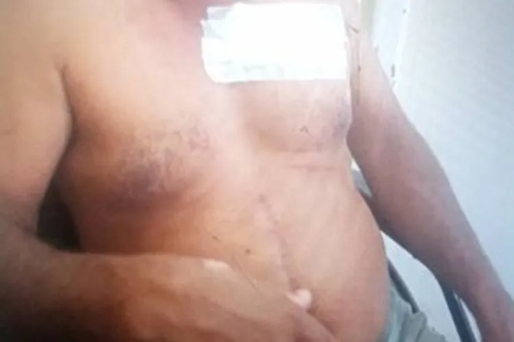 Homem é esfaqueado no tórax em Palmas de Monte Alto