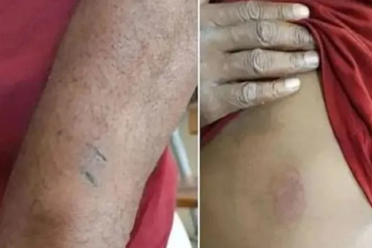 MPT-BA investiga denúncia de tortura em fazenda de Cocos