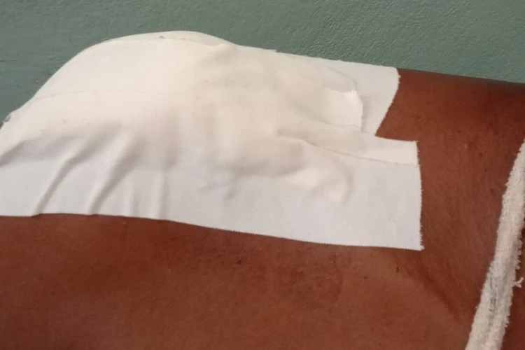 Guanambi: 'Sem profissional para um simples curativo', diz paciente sobre UPA 24h