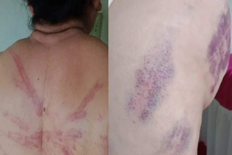 Justiça decreta prisões e três irmãs estão foragidas após espancarem idosa em Carinhanha