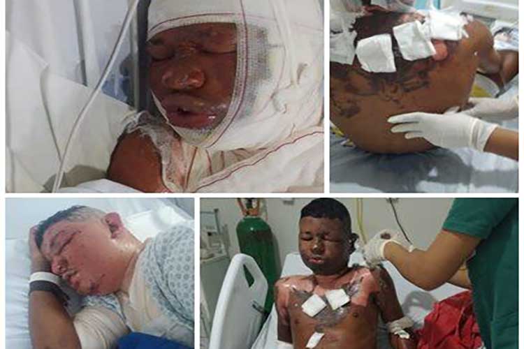 Jovem de 20 anos é torturado e queimado em Riacho de Santana