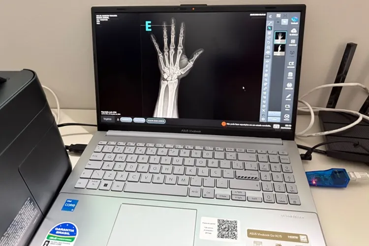 Livramento de Nossa Senhora sai na frente e adquire Raio-X Digital para a rede pública